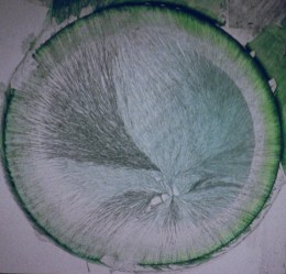 fig 5b fragilité hépatique