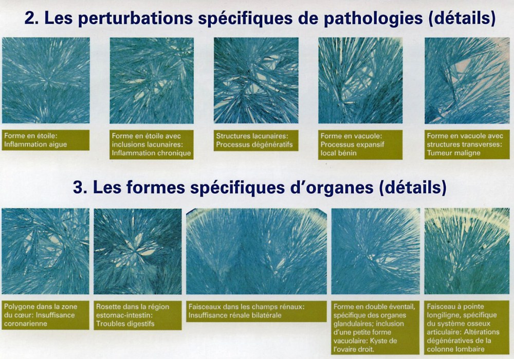 fig 8 formes spécifiques